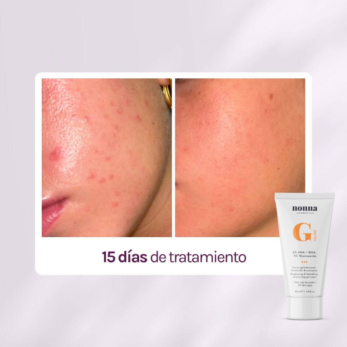 GGLOW Exfoliante - 5% Ácido Glicólico & Niacinamida - Imagen 4